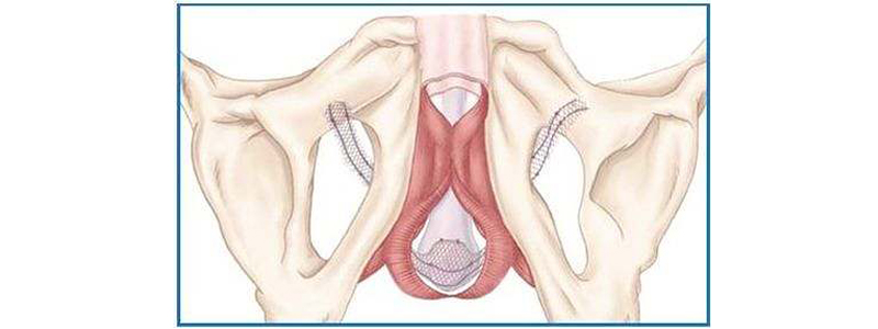 Tout savoir sur les bandelettes urinaires