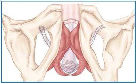 Bandelette urinaire : ça sert à quoi ? : Femme Actuelle Le MAG