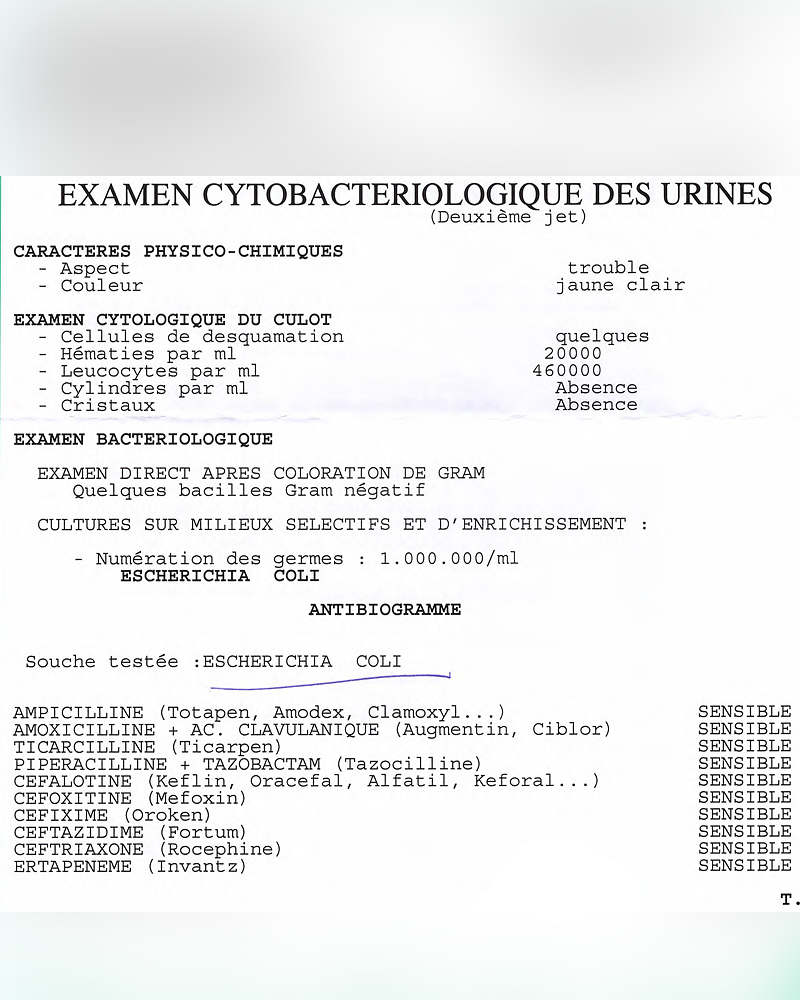 Cystite aiguë de la femme jeune - Doctinet - Plateforme de ...