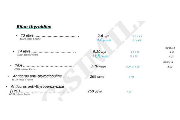 Thyroidite hashimoto